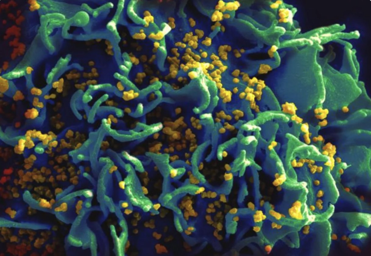 La búsqueda de una vacuna frente al sida nos trajo las vacunas para la covid