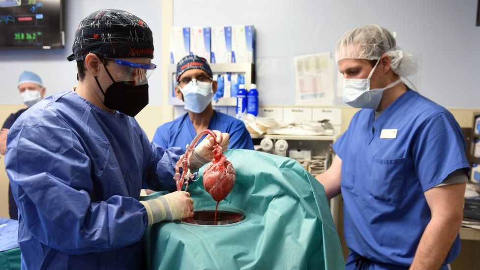 ¿El futuro pasa por los trasplantes de órganos de cerdo?