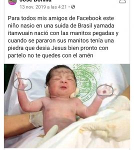 El bebé con marcas divinas en las manos: la fe y el Photoshop mueven montañas