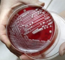 Cepa de "superbacteria" SARM resistente a los antibióticos