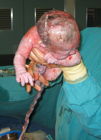 ¿Qué le pasa al cuerpo del bebé durante el parto?