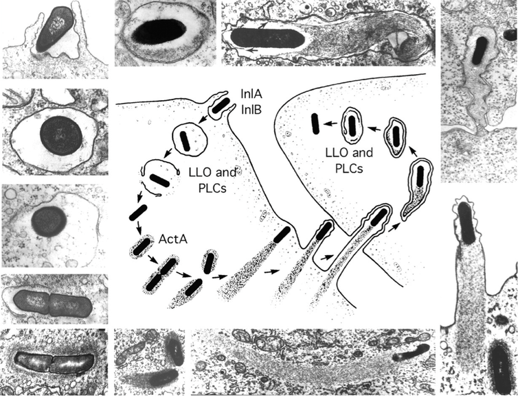 Etapas de la vida intracelular de Listeria monocytogenes. La figura del centro se basa en las micrografías electrónicas de alrededor. Daniel A. Portnoy, Victoria Auerbuch, and Ian J. Glomski - Portnoy, D.A, et al. 2002, CC BY