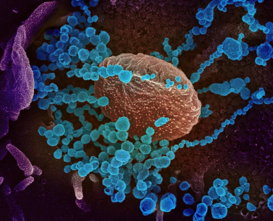 Imagen de microscopio electrónico que muestra (objetos en azul) al SARS-CoV-2, el virus que causa el brote del coronavirus COVID-19, emergiendo de la superficie de las células cultivadas en el laboratorio. EFE/ NIAID-RML