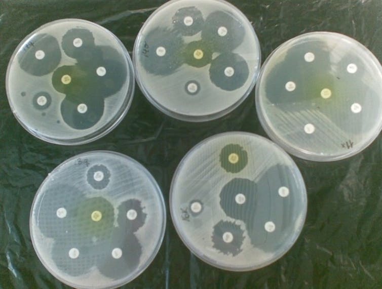 Cultivos de bacterias en laboratorio