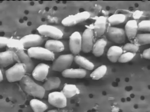 La cepa bacteriana GFAJ-1 (NASA TV).